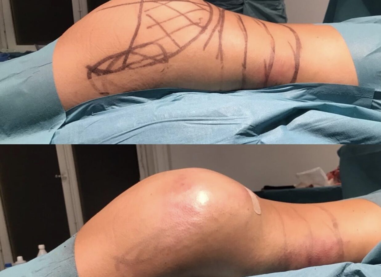 Foto 2020-03-14 12 54 24