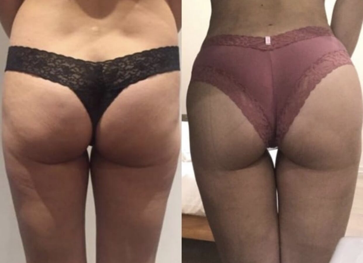 Foto 2020-03-14 12 55 29