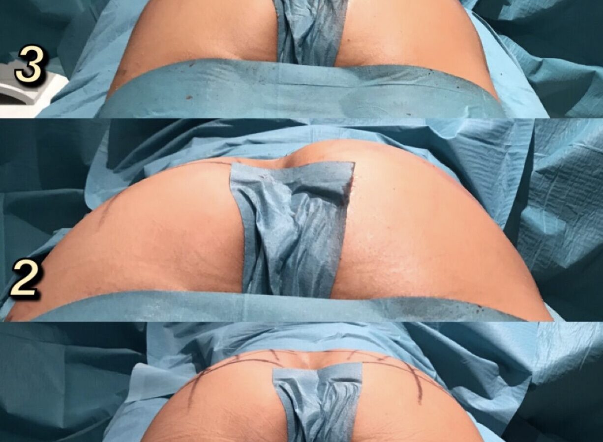 Foto 2020-03-14 15 35 02